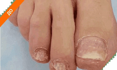 До